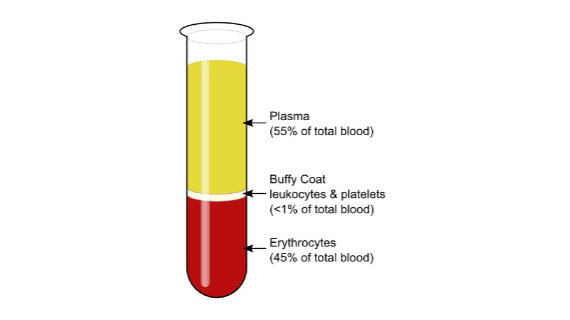 Plasma Diagram